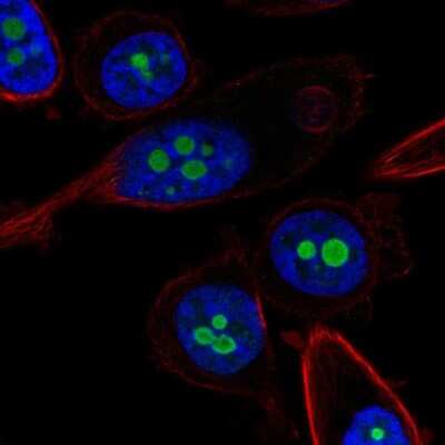 Immunocytochemistry/ Immunofluorescence: p14ARF/CDKN2A Antibody [NBP3-05521]