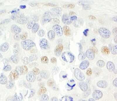 Immunohistochemistry: p14ARF/CDKN2A Antibody [NB200-158]