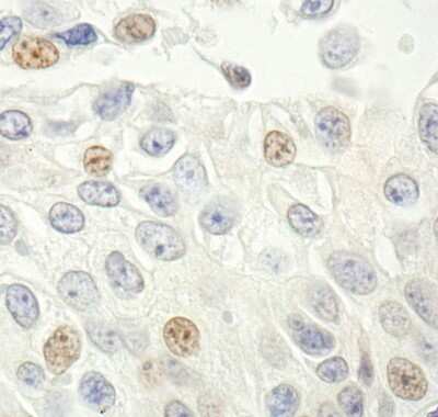 Immunohistochemistry: p14ARF/CDKN2A Antibody [NB200-159]