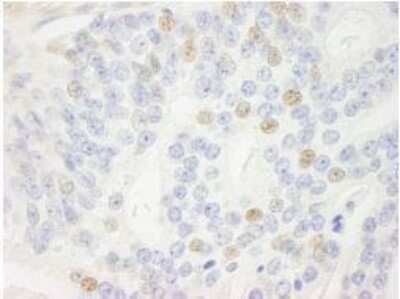 Immunohistochemistry-Paraffin: p14ARF/CDKN2A Antibody [NB200-159]