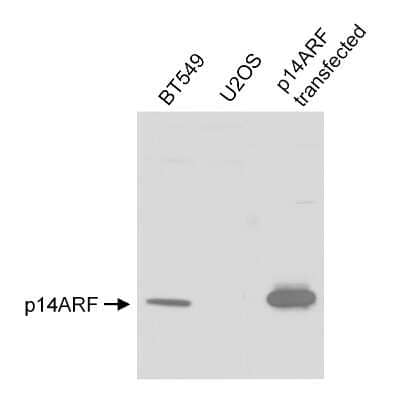 Western Blot: p14ARF/CDKN2A Antibody [NB200-158]