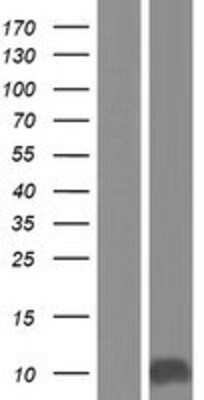 Western Blot: p15INK4b/CDKN2B Overexpression Lysate [NBP2-05789]