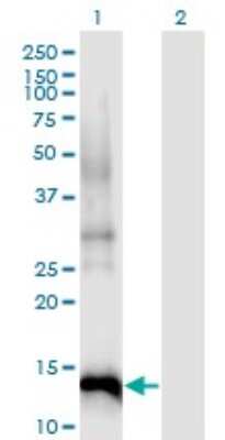 Western Blot: p15INK4b/CDKN2B Antibody (8C4) [H00001030-M07]