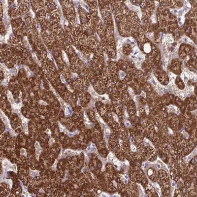 Immunohistochemistry-Paraffin: p15INK4b/CDKN2B Antibody [NBP2-38023]