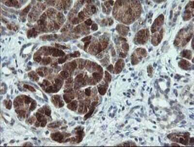 Immunohistochemistry: p15INK4b/CDKN2B Antibody (OTI3B6) [NBP2-45603]
