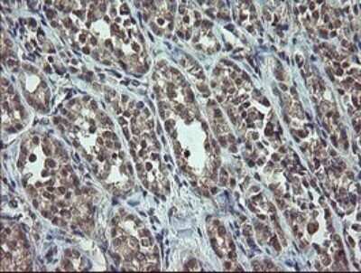 Immunohistochemistry: p15INK4b/CDKN2B Antibody (OTI3B6) [NBP2-45603]