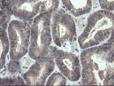 Immunohistochemistry: p15INK4b/CDKN2B Antibody (OTI3B6) [NBP2-45603]