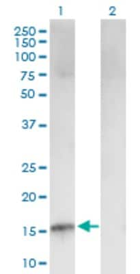 Western Blot: p15INK4b/CDKN2B Antibody [H00001030-B02P]