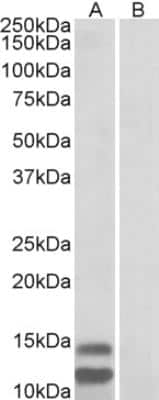 Western Blot: p15INK4b/CDKN2B Antibody [NBP2-26117]