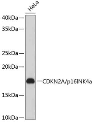 Western Blot: p16INK4a/CDKN2A Antibody (0D0C8) [NBP3-15420]