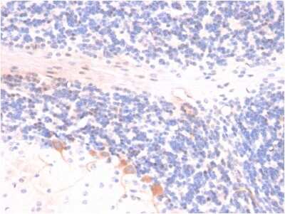 Immunohistochemistry-Paraffin: p14ARF/CDKN2A Antibody (4C6/4) - Azide and BSA Free [NBP3-08233]