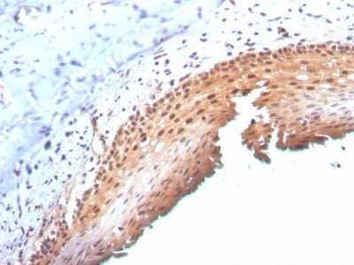 Immunohistochemistry-Paraffin: p16INK4a/CDKN2A Antibody (CDKN2A/3830) - Azide and BSA Free [NBP3-08234]