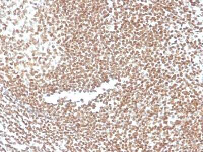 Immunohistochemistry-Paraffin: p16INK4a/CDKN2A Antibody (CDKN2A/3830) [NBP3-07235]