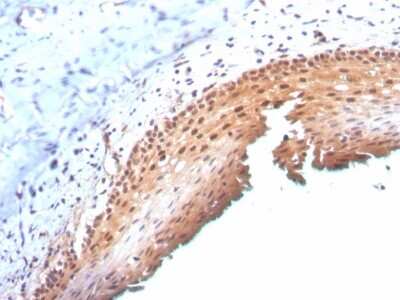 Immunohistochemistry-Paraffin: p16INK4a/CDKN2A Antibody (CDKN2A/3830) [NBP3-07235]