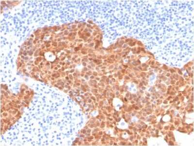 Immunohistochemistry-Paraffin: p16INK4a/CDKN2A Antibody (CDKN2A/4499) - Azide and BSA Free [NBP3-08438]