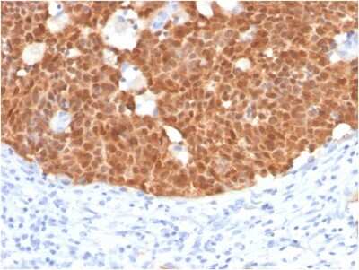 Immunohistochemistry-Paraffin: p16INK4a/CDKN2A Antibody (CDKN2A/4499) - Azide and BSA Free [NBP3-08438]