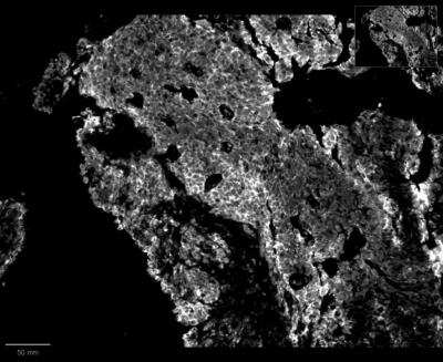 Immunohistochemistry-Paraffin: p16INK4a/CDKN2A Antibody (CDKN2A/4499) - Azide and BSA Free [NBP3-08438]