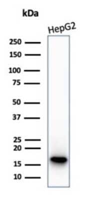 Western Blot: p16INK4a/CDKN2A Antibody (CDKN2A/4844R) [NBP3-13833]