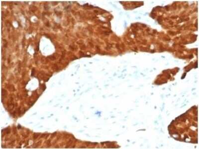 Immunohistochemistry-Paraffin: p16INK4a/CDKN2A Antibody (CDKN2A/7081R) [NBP3-13834]