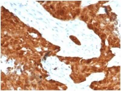 Immunohistochemistry-Paraffin: p16INK4a/CDKN2A Antibody (CDKN2A/7081R) [NBP3-13834]