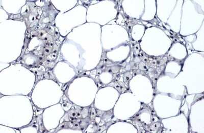 Immunohistochemistry-Paraffin: p16INK4a/CDKN2A Antibody (GT1249) [NBP3-13669]