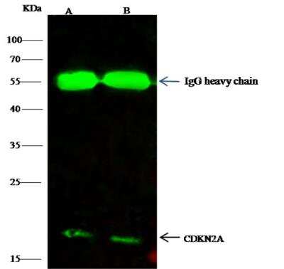 Immunoprecipitation: p16INK4a/CDKN2A Antibody [NBP2-98881]