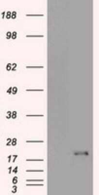 Western Blot: p16INK4a/CDKN2A Antibody (OTI4C11) [NBP2-45602]