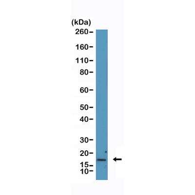 Western Blot: p16INK4a/CDKN2A Antibody (RM409) [NBP2-89102]