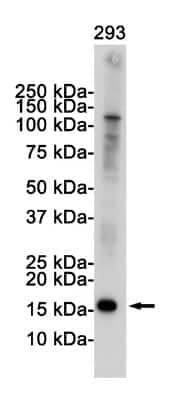 Western Blot: p16INK4a/CDKN2A Antibody (S04-8C9) [NBP3-14885]