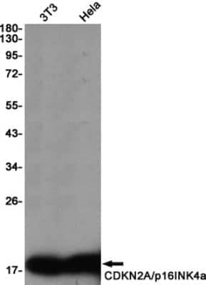 Western Blot: p16INK4a/CDKN2A Antibody (S04-8C9) [NBP3-14885]