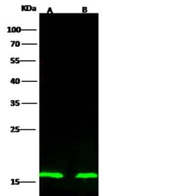 Western Blot: p16INK4a/CDKN2A Antibody [NBP2-98881]