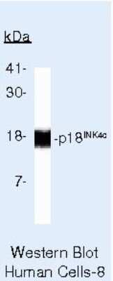 Western Blot: p18INK4c/CDKN2C Antibody (18P118 (DCS-118)) [NB120-3216]