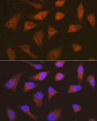 Immunocytochemistry/ Immunofluorescence: p18INK4c/CDKN2C Antibody (1Q10Q4) [NBP3-16695]