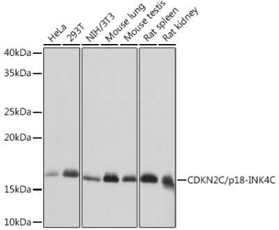 Western Blot: p18INK4c/CDKN2C Antibody (1Q10Q4) [NBP3-16695]