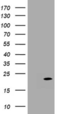 Western Blot: p18INK4c/CDKN2C Antibody (OTI2E1) [NBP2-46229]