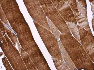 Immunocytochemistry/ Immunofluorescence: p18INK4c/CDKN2C Antibody [NBP3-12954]