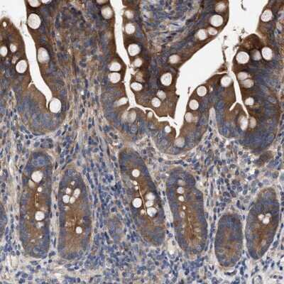 Immunohistochemistry-Paraffin: p18INK4c/CDKN2C Antibody [NBP1-87687]