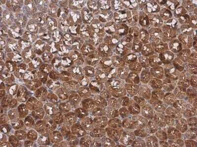 Immunohistochemistry-Paraffin: p18INK4c/CDKN2C Antibody [NBP3-12954]