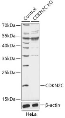 Knockout Validated: p18INK4c/CDKN2C Antibody - Azide and BSA Free [NBP3-03298]