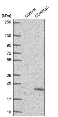 Western Blot: p18INK4c/CDKN2C Antibody [NBP1-87687]