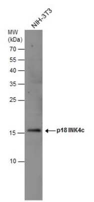 Western Blot: p18INK4c/CDKN2C Antibody [NBP3-12954]