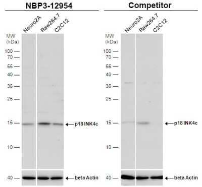 Western Blot: p18INK4c/CDKN2C Antibody [NBP3-12954]