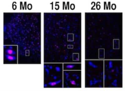 Immunocytochemistry/ Immunofluorescence: p19 INK4d Antibody (DCS-100) [NBP3-11884]