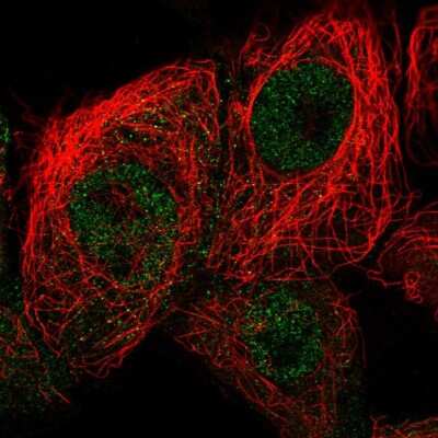 Immunocytochemistry/ Immunofluorescence: p19 INK4d Antibody [NBP2-58778]