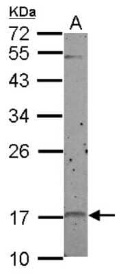 Western Blot: p19 INK4d Antibody [NBP2-19651]