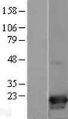 Western Blot: p19 INK4d Overexpression Lysate [NBL1-09056]