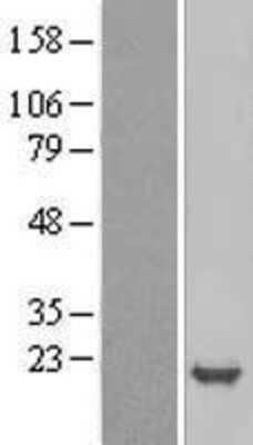 Western Blot: p19 INK4d Overexpression Lysate [NBL1-09057]