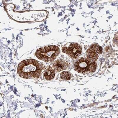 Immunohistochemistry-Paraffin: p190RhoGAP Antibody [NBP2-49172]