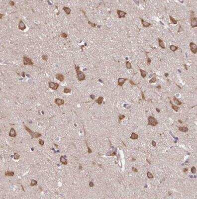 Immunohistochemistry-Paraffin: p190RhoGAP Antibody [NBP2-49172]