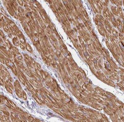 Immunohistochemistry-Paraffin: p190RhoGAP Antibody [NBP2-49172]